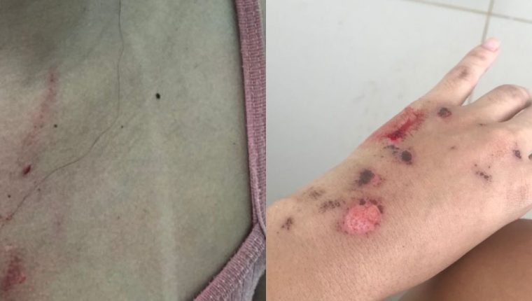 Caso Keren Leão: ex-namorado é acusado por 20 mulheres de agressões e golpes. Relatos apontam violência física com cadeiras, manipulação financeira e estelionato.