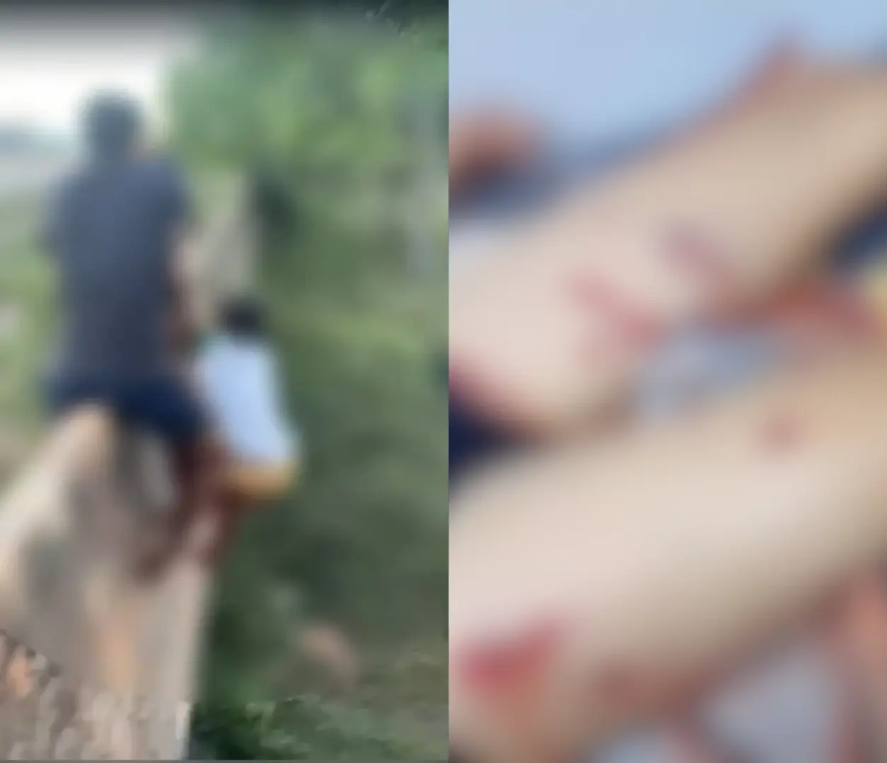 Criança de 10 anos recebeu atendimento médico após ser atacada por um porco-do-mato da espécie caititu em Governador Nunes Freire.